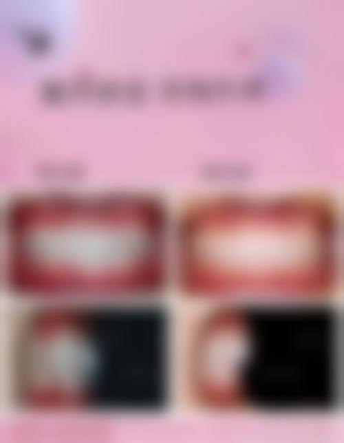 擅长项目详解