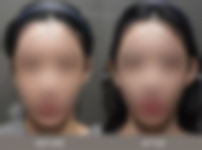 廖汉聪医生项目收费价格
