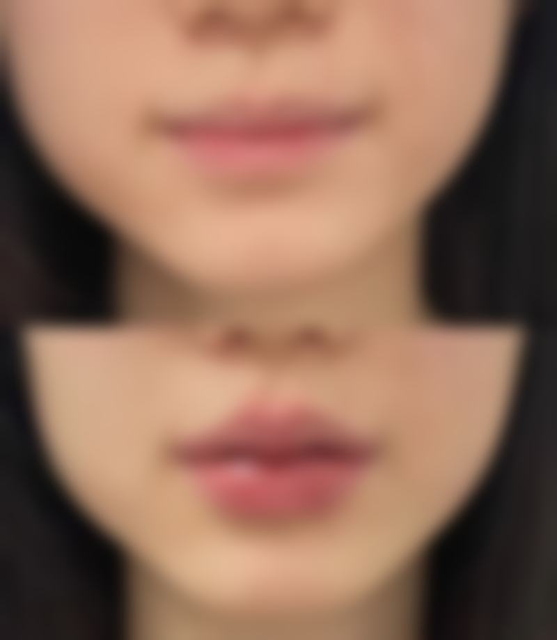 广州巧曼医疗美容诊所特色诊疗项目与技术优势