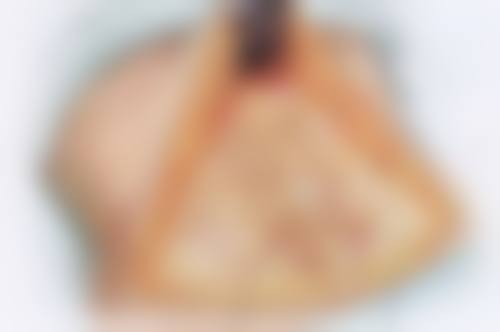 钟茜医生技术优势