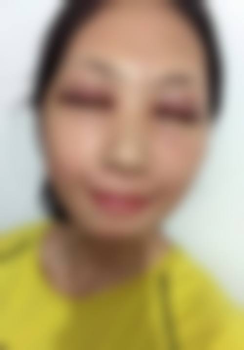 任明君医生预约挂号