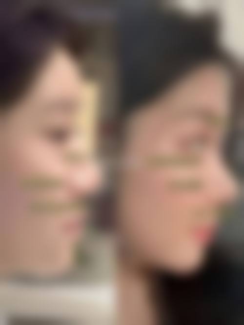 孙辉医生项目收费价格