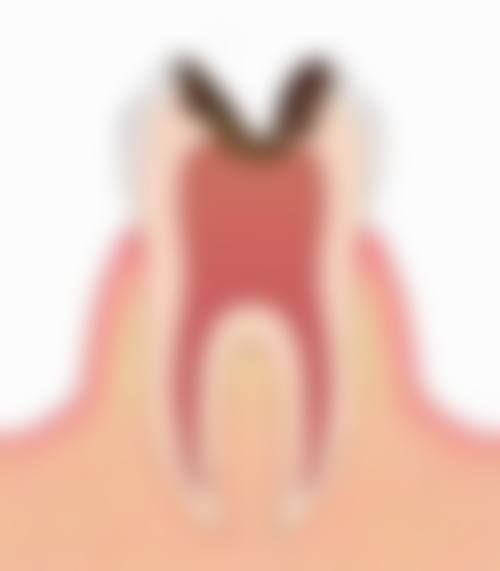 临床实例分享
