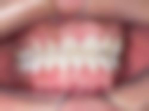 预约优惠活动
