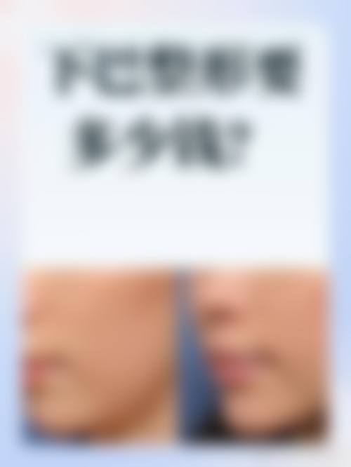 崔晶医生项目收费价格