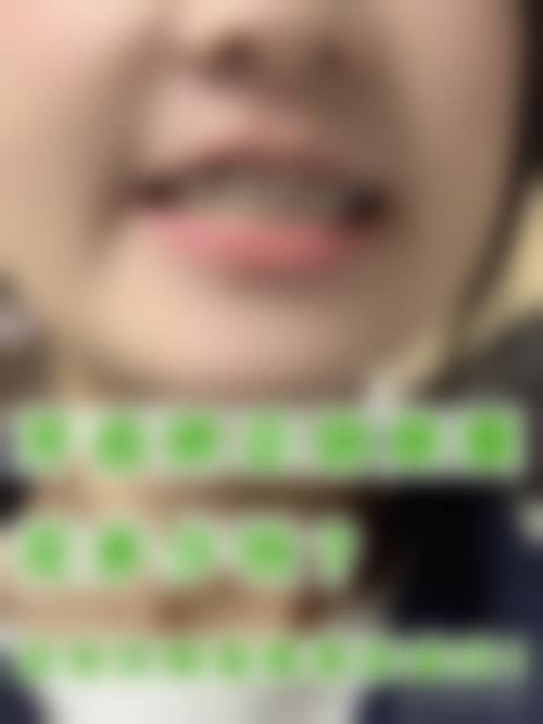 患者真实评价