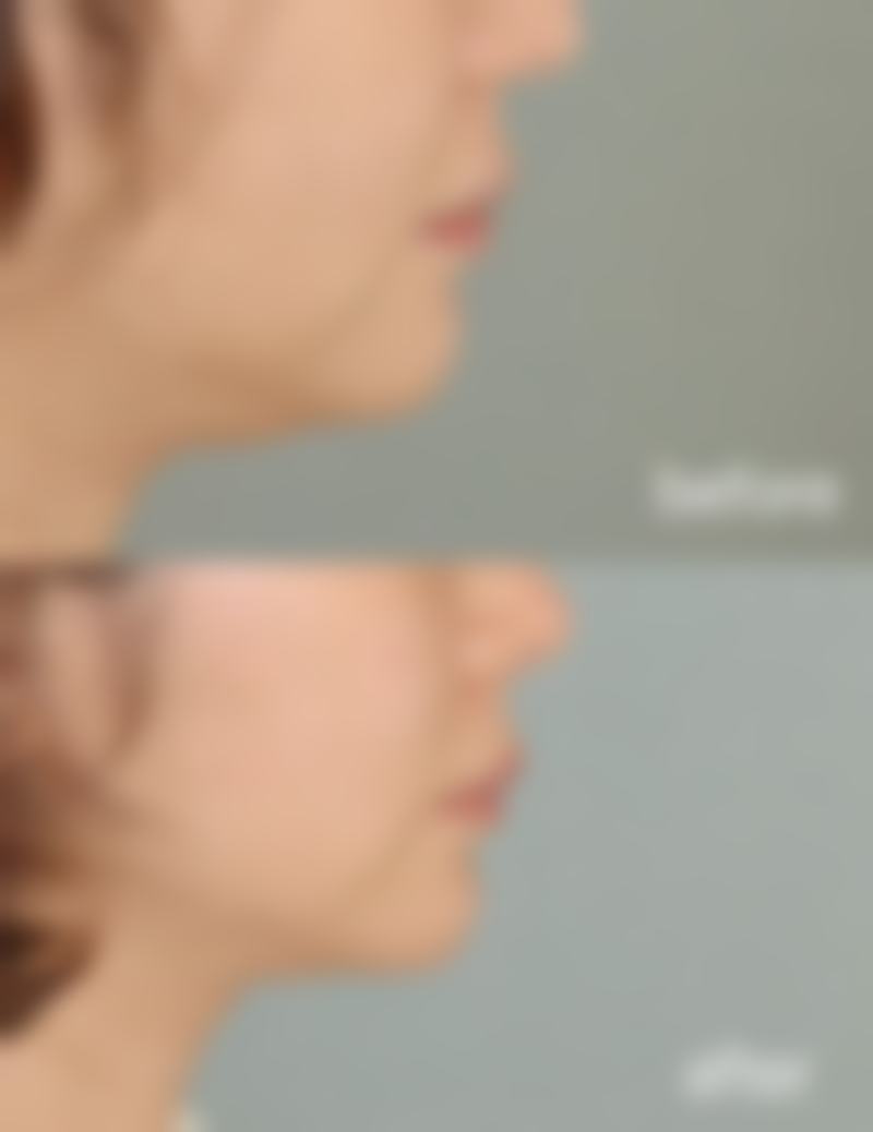 崔晶医生技术优势