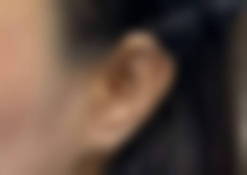 医院收费与优惠:透明价格,美丽安心
