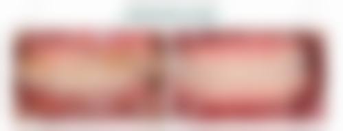 优惠活动详情:限时补贴助您省钱