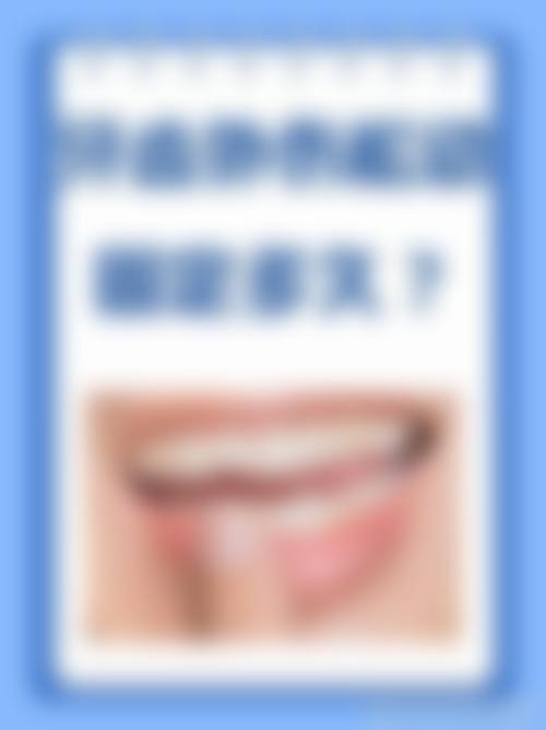 预约优惠活动