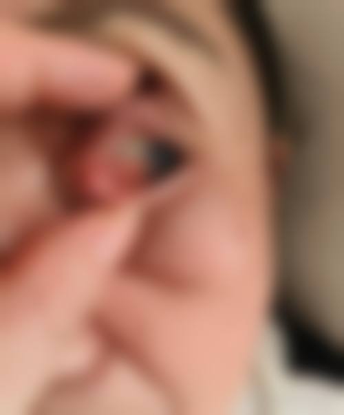 总结与预约号召