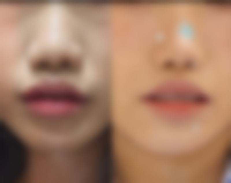 韩国济州岛slow整形外科医疗环境与配套设施