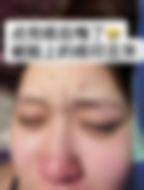 擅长项目详解