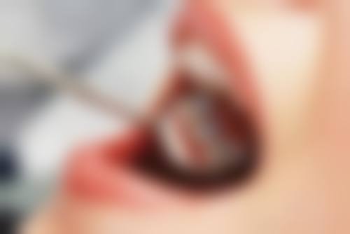 擅长项目详解
