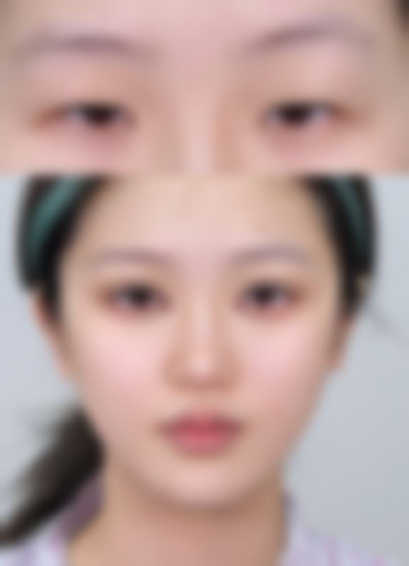 临床实例分享