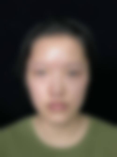 柏宏亮医生技术优势