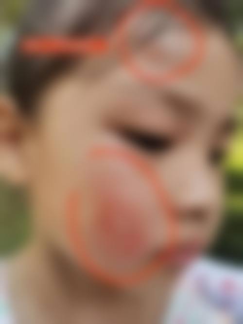 优惠活动详情:普惠医疗,减轻负担