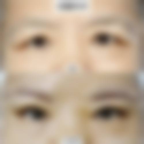 临床实例分享