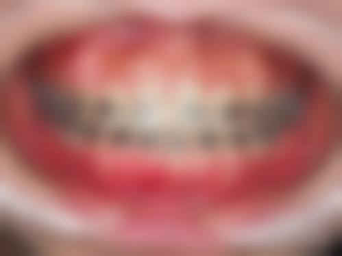 结尾:选择新起点,从齿开始