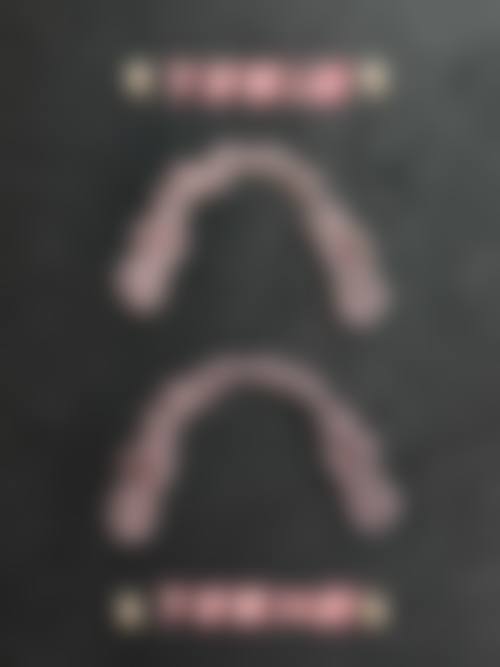 预约优惠活动