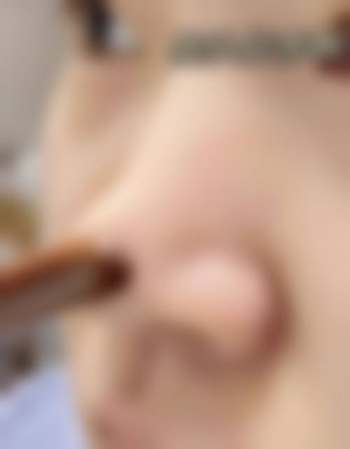 临床实例分享