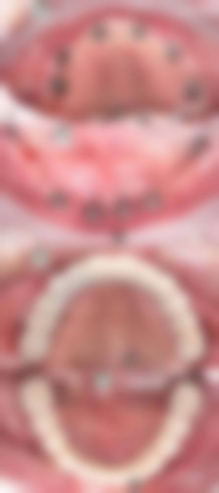 FAQ:常见问题解答
