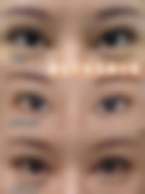 郑粲澔医生项目收费价格