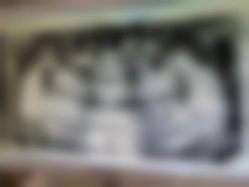 优惠活动详情:限时补贴到院即享