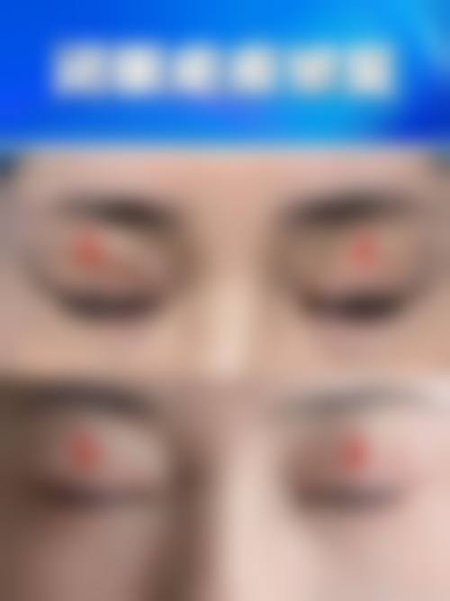 优惠活动详情:限时补贴,名额有限