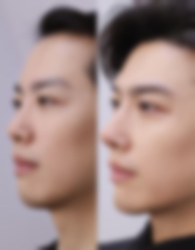 黄松杰医生项目收费价格