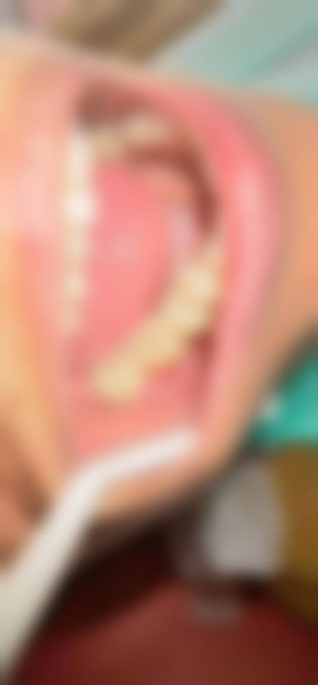 患者真实评价:患者眼中的许江汉医生