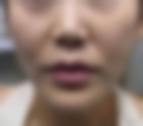 擅长项目详解