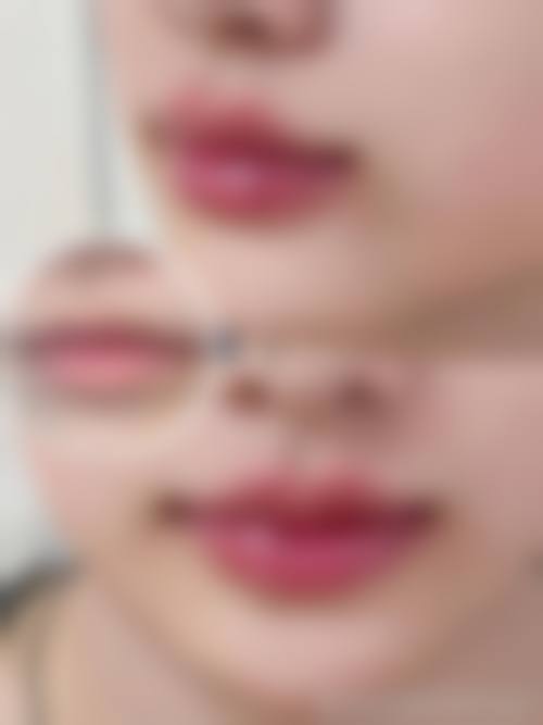 厦门长庚医院整形美容科怎么样?这是一家什么样的医院?