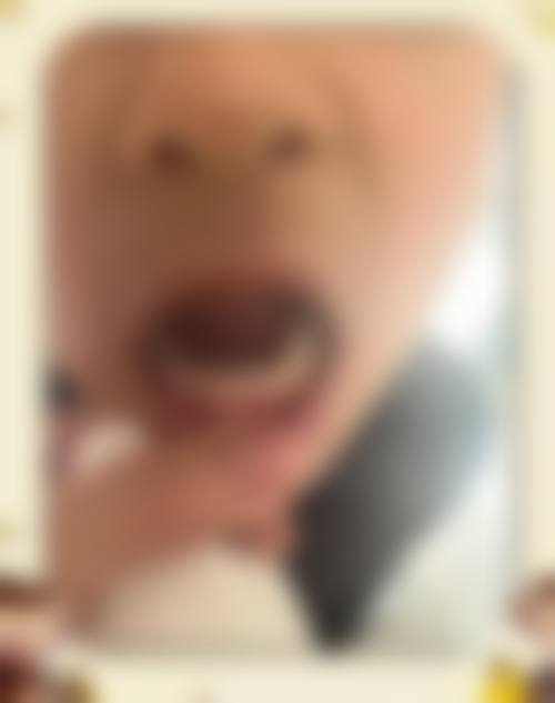 蒙自吉祥口腔门诊张顺凯医生的收费价格参考(2026年)