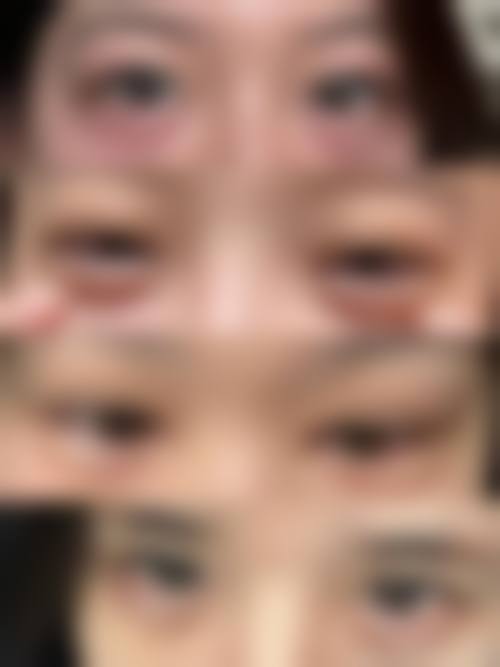 结语:选择正规医美,绽放自信之美