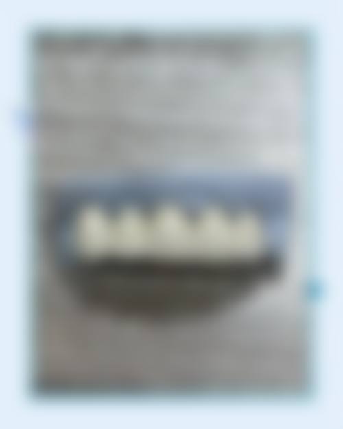 擅长项目详解