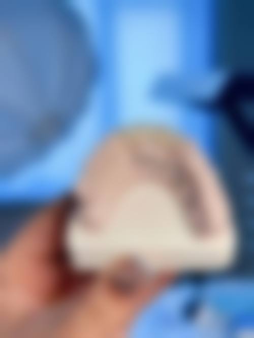 擅长项目详解