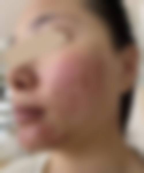 优惠活动详情:限时特别优惠,预约即享