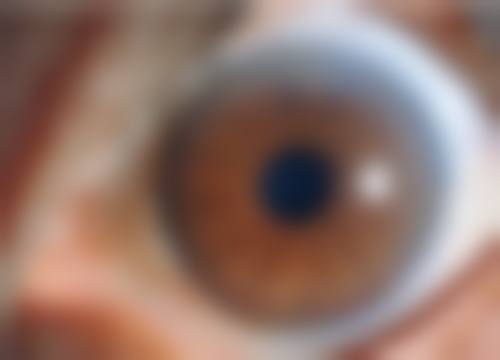江苏泰州张勤眼科医院医生团队:名咖坐诊技术有保护