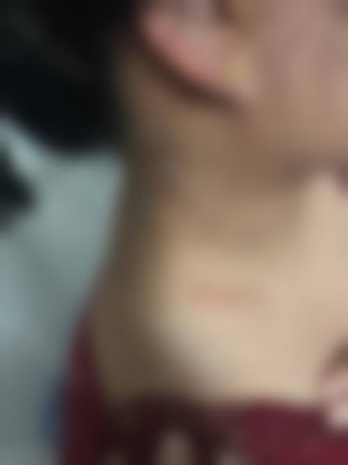 患者真实评价