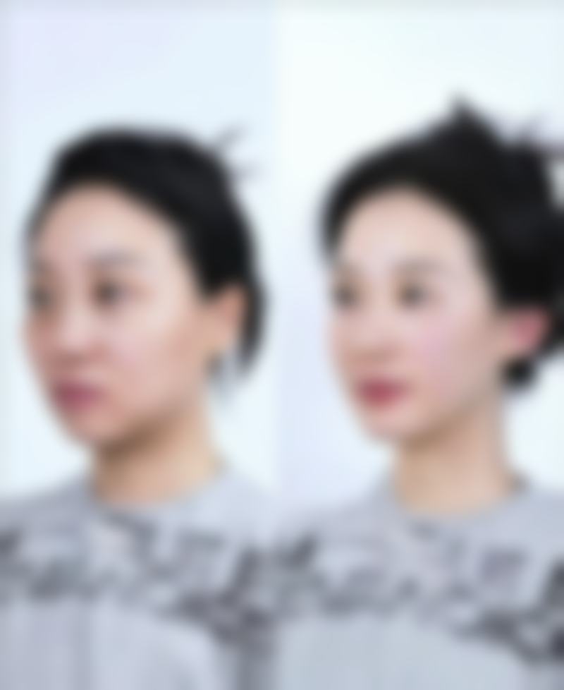 晋中蜜浠新颜整形医院的技术优势与设备保护