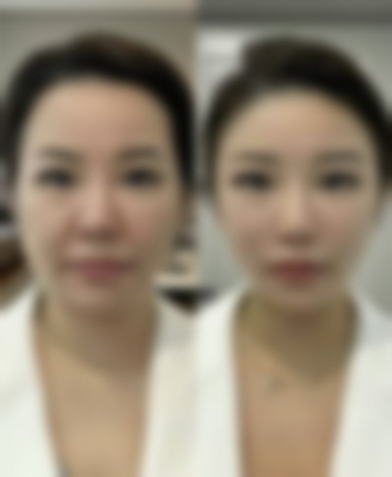 晋中蜜浠新颜整形医院怎么样?资质正规吗?